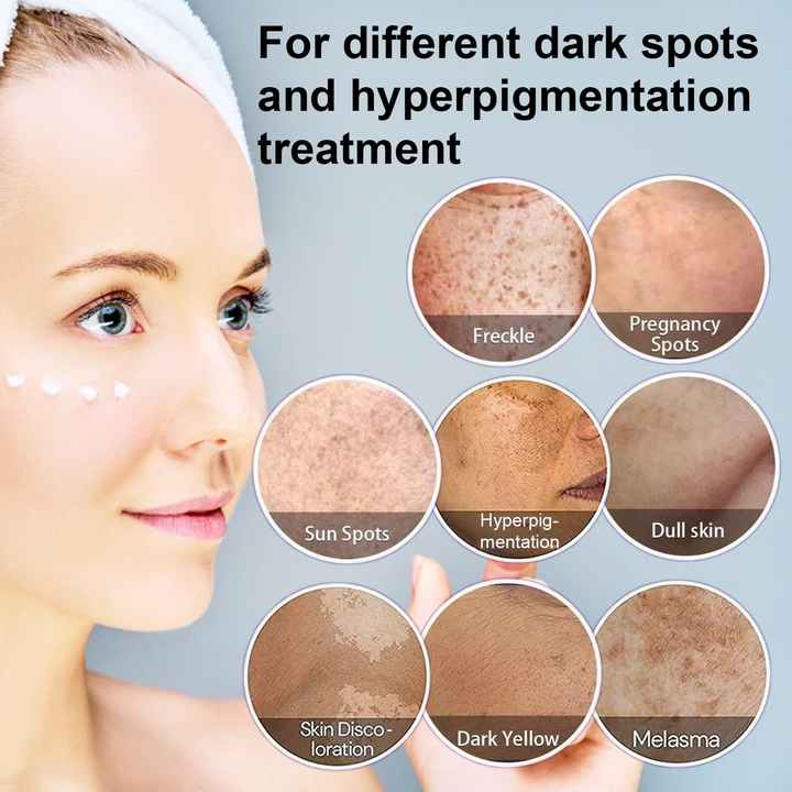 Corrector Cream Dark Spot Yt