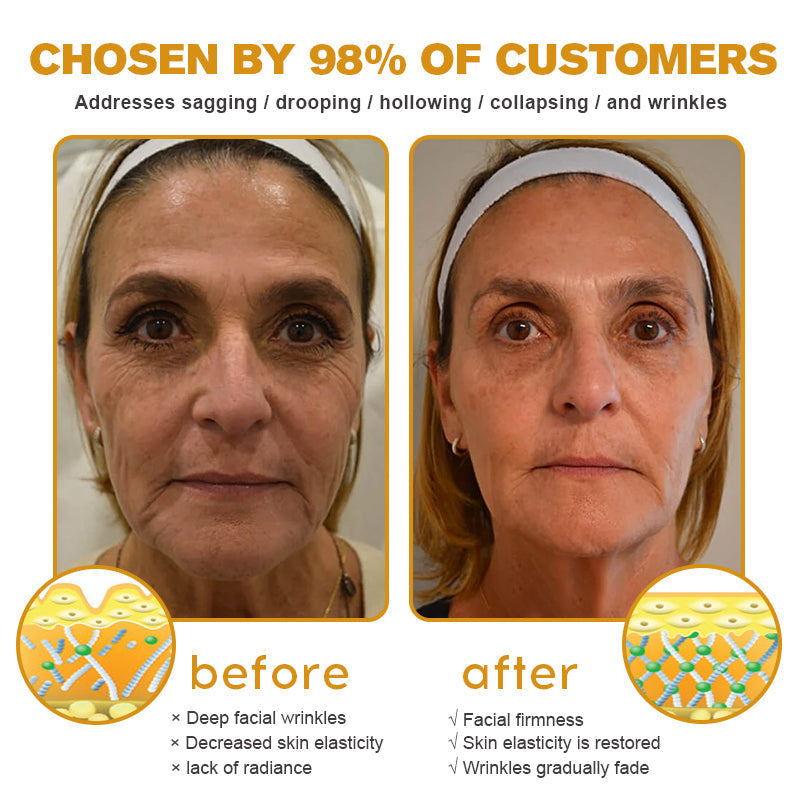 Erase Wrinkles Naturally – for Men & Women